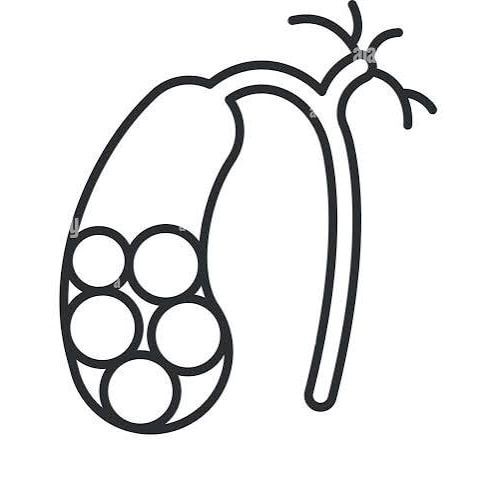 conditions.gallstones