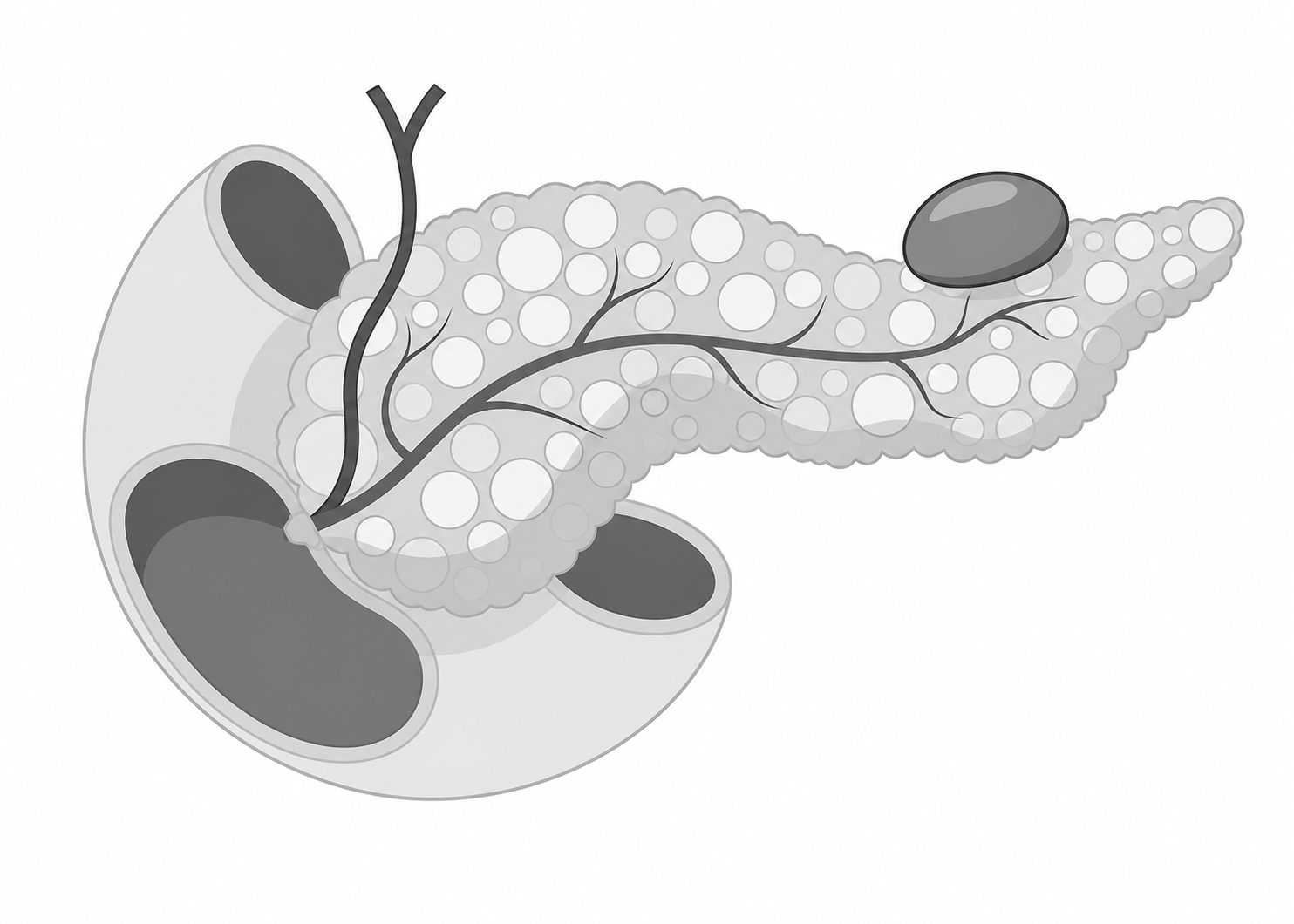 conditions.pancreaticCysts